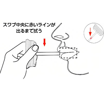 手順イラスト：検査準備