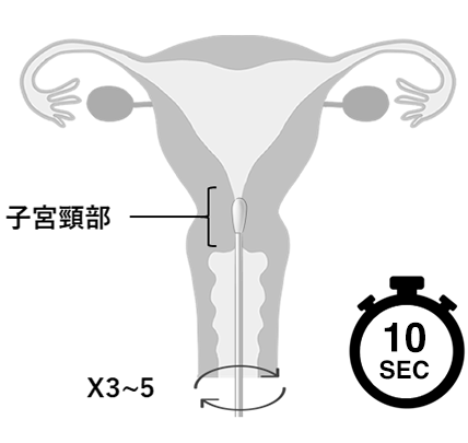 手順イラスト：検体浮遊